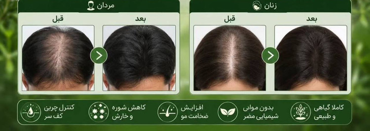 🛍️صابون رزماری